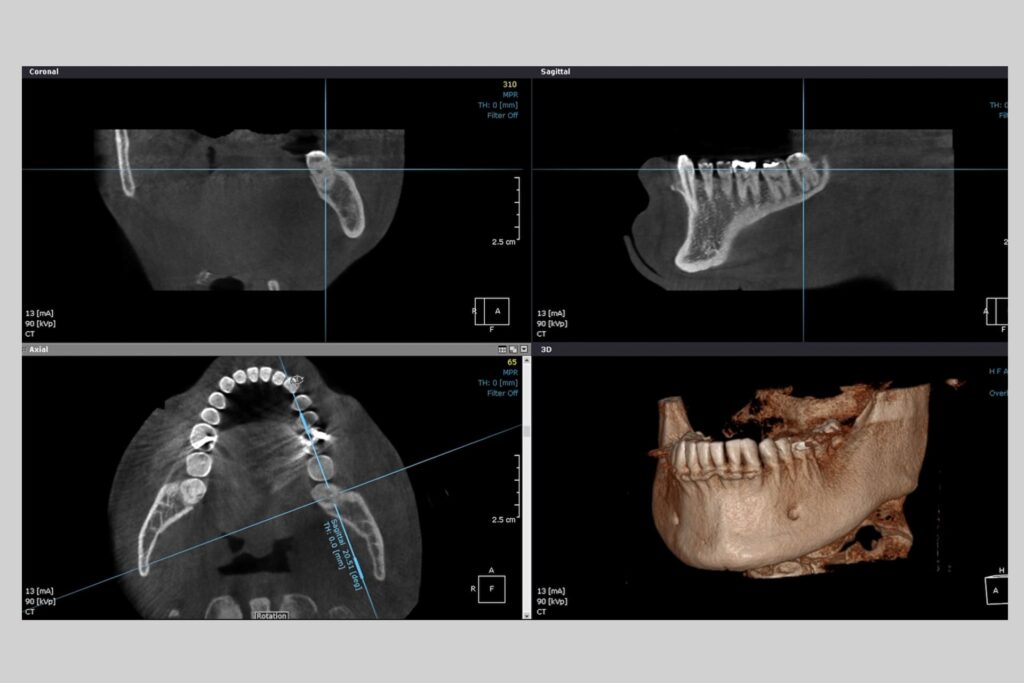 Radiologia digitale 2D e 3D